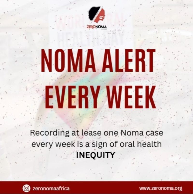 Noma Alert Every Week