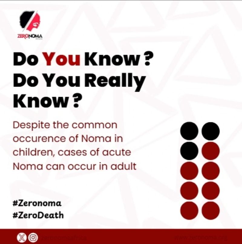 The adult onset of Noma is a new reality that is challenging 