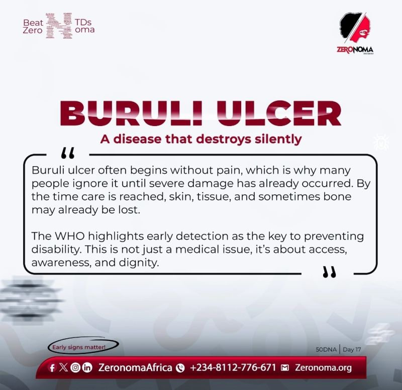 part of the twenty-one diseases classified as Neglected Tropical Diseases (NTDs) by the World Health Organization