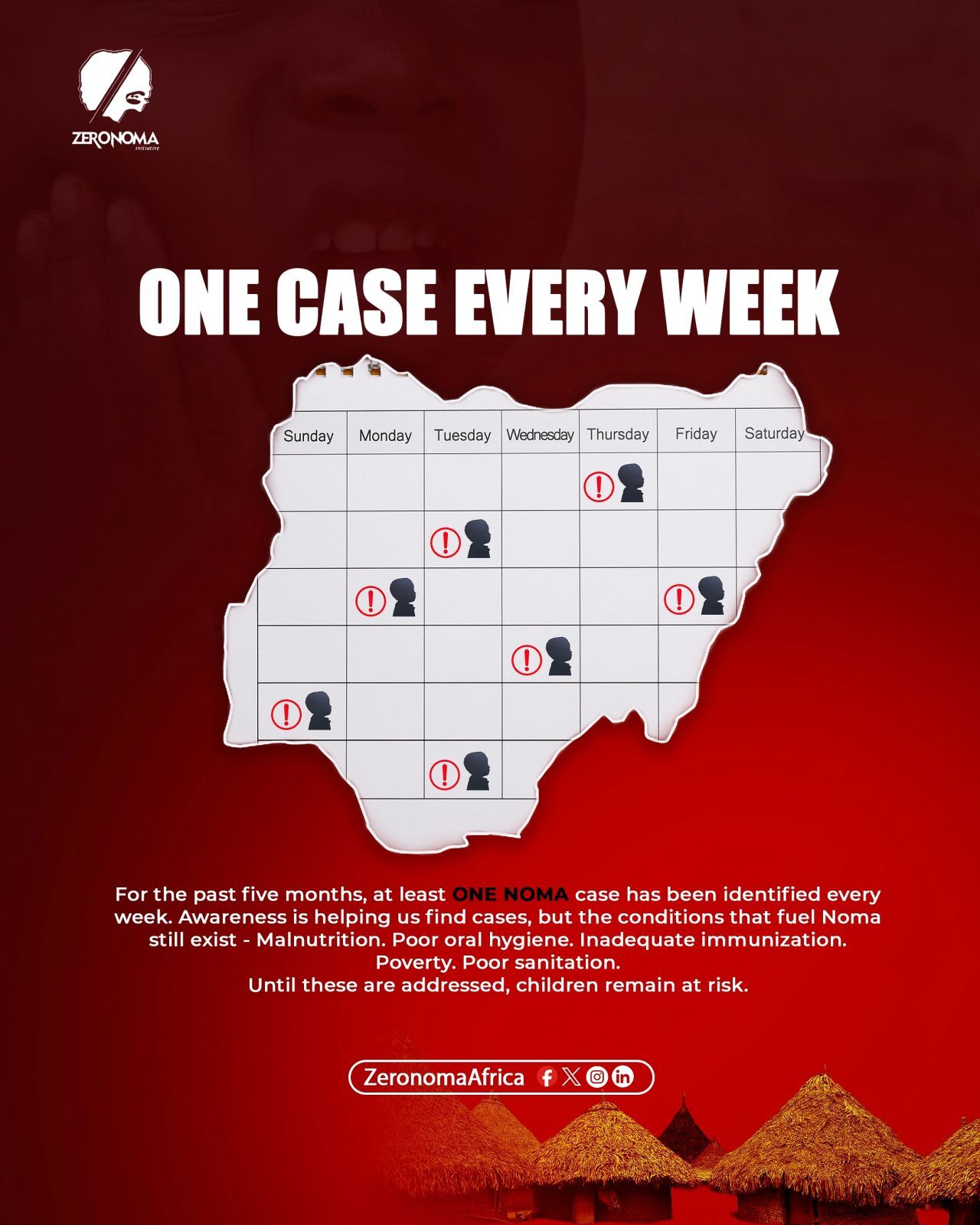 Over the past five months, we have identified at least one Noma case every week.