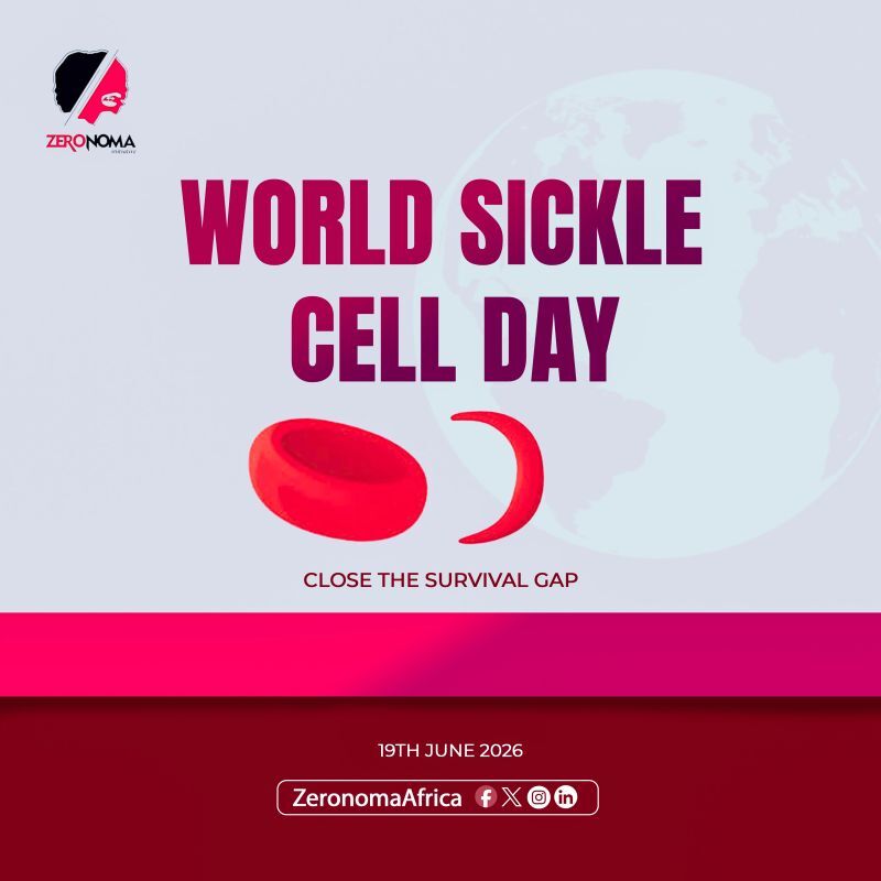 Today, on World Sickle Cell Day, we recognize the resilience of sickle cell warriors and the unique health…